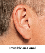 IIC hearing aid solutions